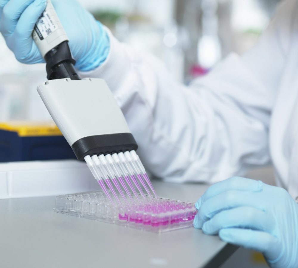 Scientist using multi-channel pipette to fill multiwell plate for analysis of antibodies by ELISA